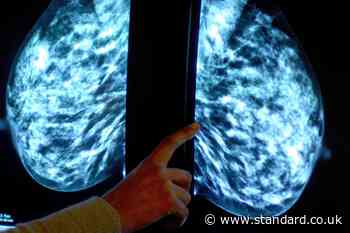 Preserving breast tissue outside of body will aid cancer research – study