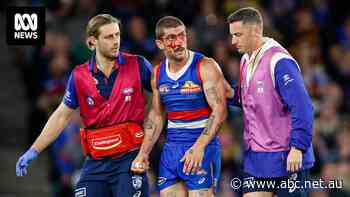 'Don't go for this one': Bulldogs coach opens up about concussion concerns as Liberatore return revealed