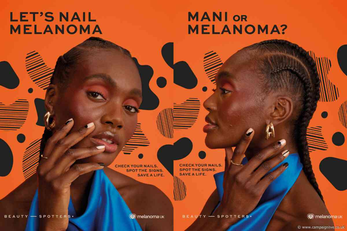 Melanoma UK launches campaign to help dispel skin cancer myths in dark skin
