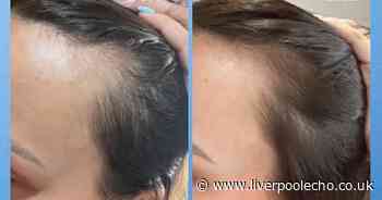 Hair growth serum gives 'double the amount of hair' in five weeks