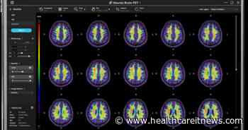 National University Hospital testing predictive AI for Alzheimer's diagnosis and more AI briefs
