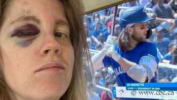 Jays fan hit in face by ball to get ball signed by Bo Bichette