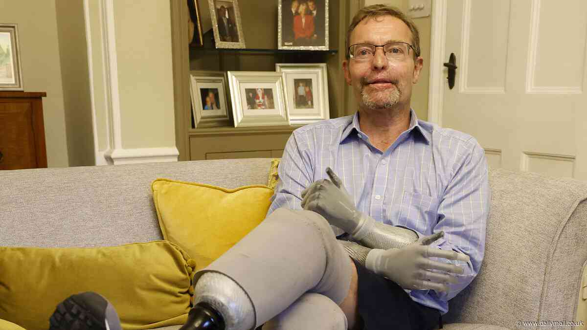 The bionic MP: Craig Mackinlay breaks his silence after losing both his hands and feet to sepsis - and admits he was 'lucky to be alive' after horror illness that left him with four prosthetic limbs