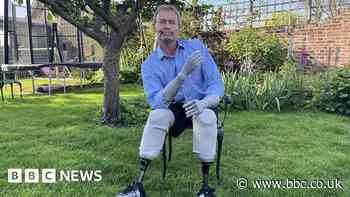 'They looked dead': MP speaks about sepsis limb loss