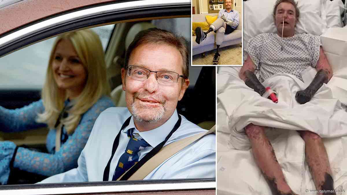 'Bionic MP' Craig MacKinlay returns to the Commons for the first time since losing his blackened hands and feet to sepsis as he's driven to Parliament by his pharmacist wife