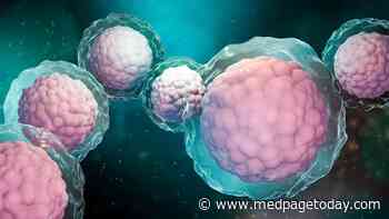 Undergoing Stem Cell Transplant for Myelofibrosis