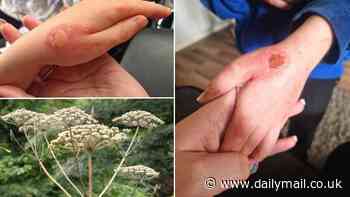 Britain's 'most dangerous plant' strikes in County Down: Schoolboy, 8, is left with painful blisters over his hands and arms after accidentally brushing past giant hogweed
