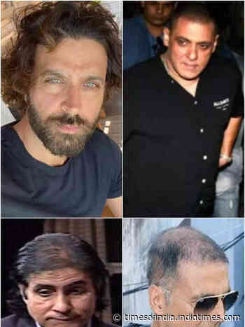 Bollywood actors who underwent hair transplants