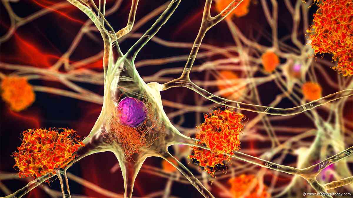 Lifestyle-Dementia Links Persist Regardless of Risk Genes, French Study Shows