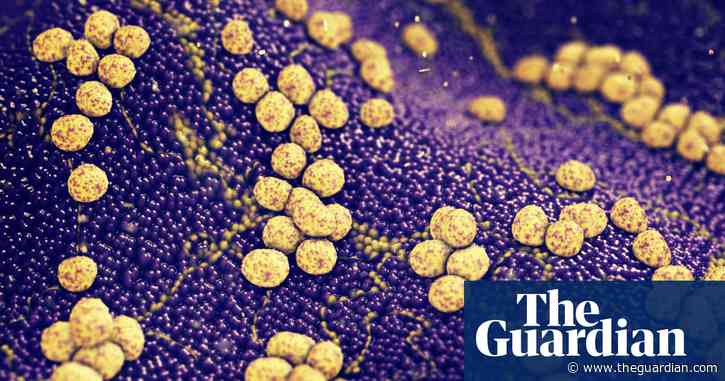 Huge number of deaths linked to superbugs can be avoided, say experts