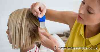 Treating head lice explained as Superdrug issues country-wise alert