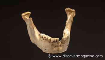 Ancient Neanderthal and Paleolithic Teeth Show Signs of Childhood Stress