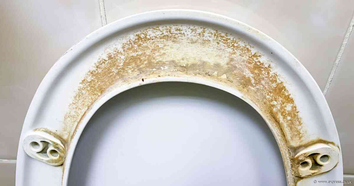 Remove stubborn toilet seat stains in eight minutes for good with one item expert ‘loves’