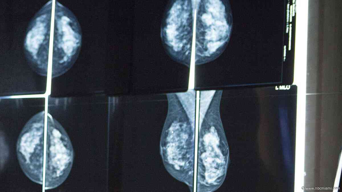 Dense breast patients battle to get coverage for cancer screenings