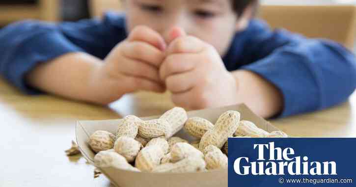 Giving young children peanut products cuts allergy risk, study finds