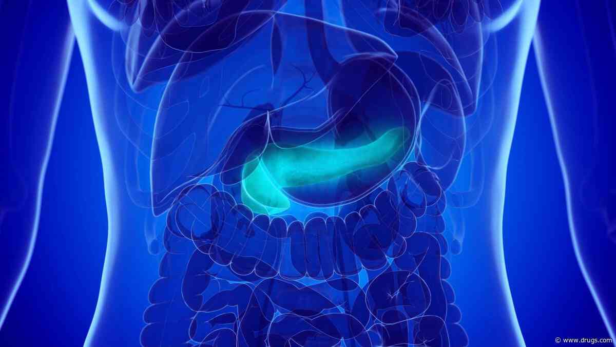 Extracorporeal Shock-Wave Lithotripsy, Endoscopy Beneficial for Pancreatitis
