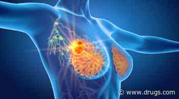 Omission of SLNB Feasible for Younger Patients With ER+/cN0 Breast Cancer