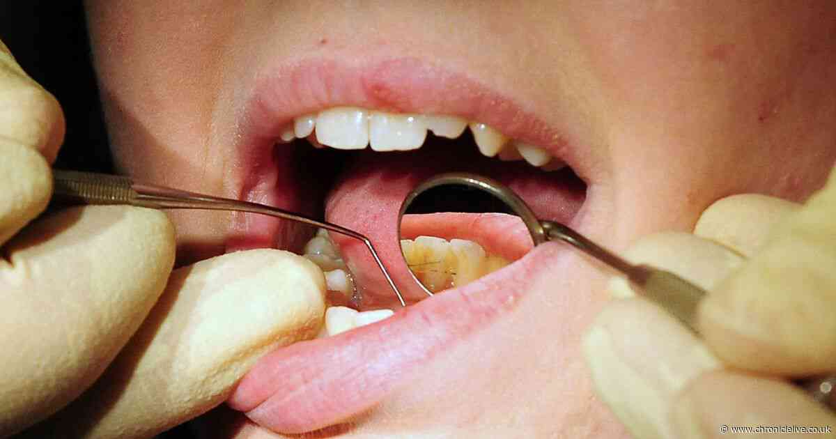 Newcastle researchers looking for smokers for study to track dental health across 600 years
