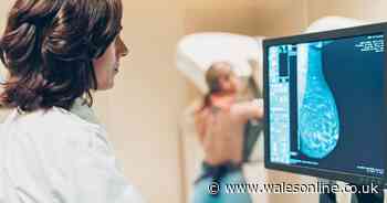 Breast cancer warning as 'significant number' miss screenings