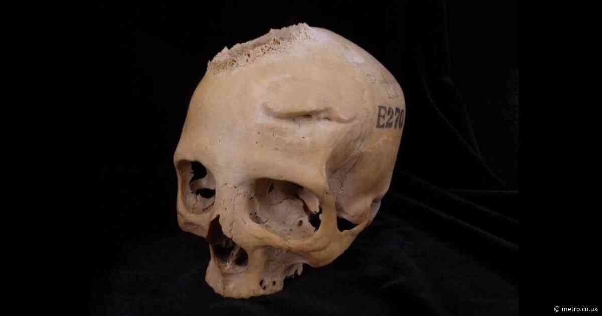 ‘Extraordinary’ 4,000-year-old Egyptian skull may show signs of attempts to treat cancer