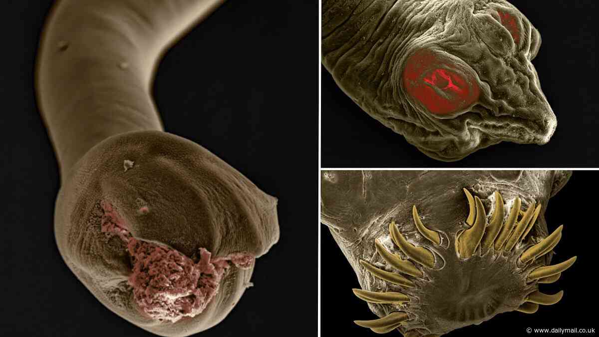 Revealed: Terrifying images show the dangerous worms that could be lurking inside your pet magnified 180 times
