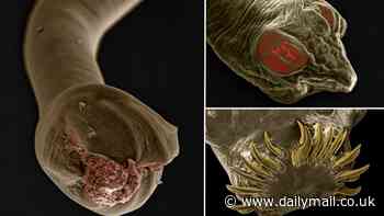 Revealed: Terrifying images show the dangerous worms that could be lurking inside your pet magnified 180 times