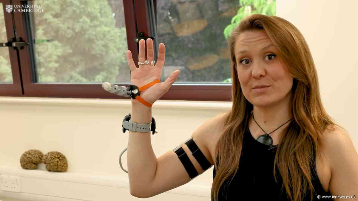 Robotic 'Third Thumb' Makes Tasks Possible With One Hand; Can Be A Game Changer For The Disabled