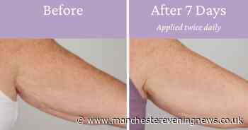 The £23 sagging arm cream that 'shows results in 7 days' giving shoppers confidence to wear short sleeves again this summer