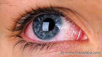 Updated Guidelines for Dry Eye Syndrome