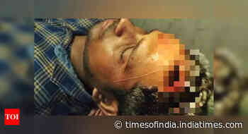 West Bengal: Journalist injured in TMC-BJP clashes during Lok Sabha polls