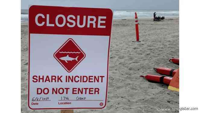 Swimmer seriously injured in shark attack on San Diego County coast