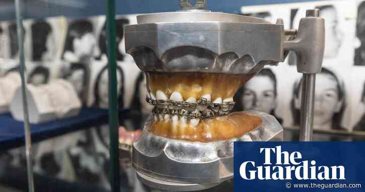 Oral history: how Tick Begg revolutionised braces and made 1920s Adelaide ‘the orthodontic centre of the world’