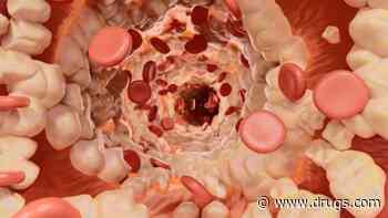 Plozasiran Reduces Triglyceride Levels in Mixed Hyperlipidemia