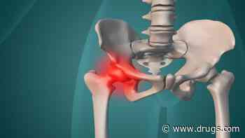 Odds of Death Lower With Surgery for Hip Fracture in Patients With Dementia