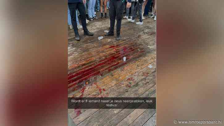 Bloederige foto bij festival komt door gescheurde lip: 'Gaat goed met hem'