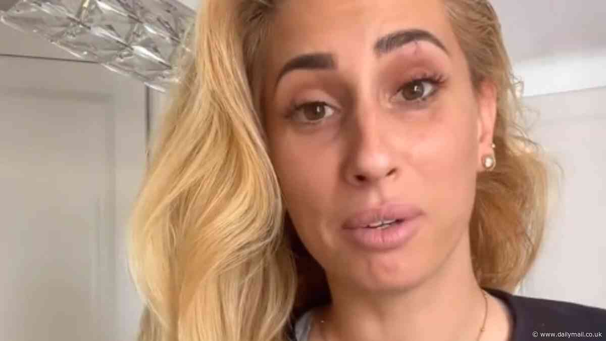 Stacey Solomon gives herself a black eye while trying to build a coop for her new ducklings after revealing her plans to give up showbiz to be a stay at home mum