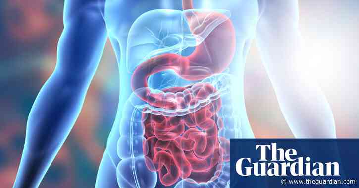 Bowel disease breakthrough as researchers make ‘holy grail’ discovery