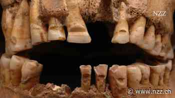 Wikinger hatten eingeritzte Zähne und verformte Schädel – als Zeichen der Macht