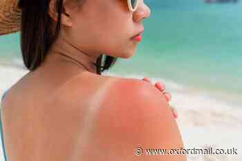 How to treat sunburnt skin: Dermatologist shares 6 tips