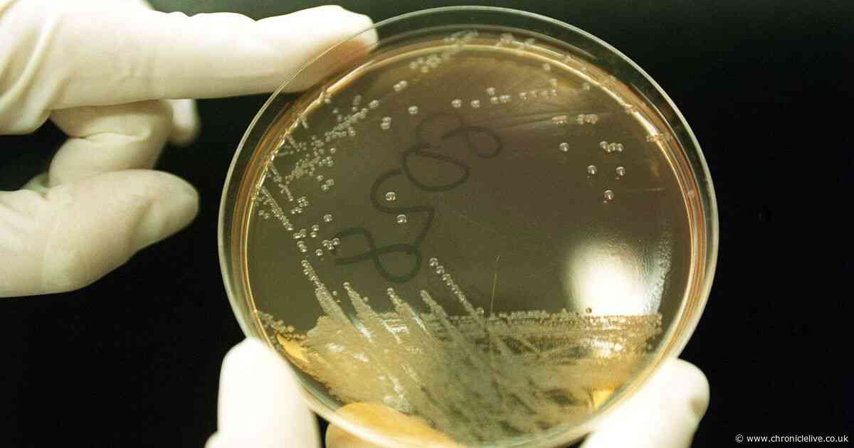 Health experts confirm E.coli outbreak across UK with 113 cases and people admitted to hospital