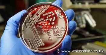 18 people in Wales ill after E.coli outbreak linked to food