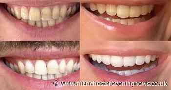 Shoppers 'floored' when they see results of 'dentist approved' £25 teeth whitening solution now on 3 for 2 offer