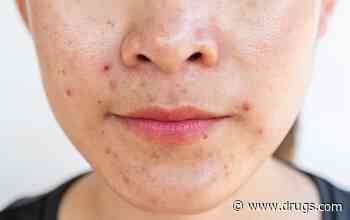 Isotretinoin Effective for Acne in Those Receiving Gender-Affirming Therapy