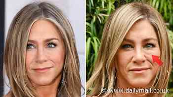Surgeon claims Jennifer Anniston's new 'tired and aged' face is due to botched filler - years after actress said plastic surgery was a 'slippery slope'