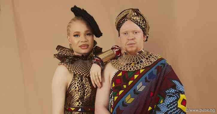 7 daily challenges people living with albinism in Nigeria face