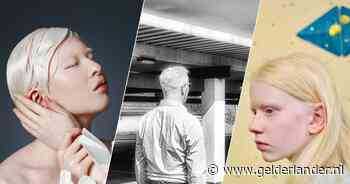 Hoe is het om te leven met albinisme? ‘Autorijden gaat niet en ik draag bijna altijd donkere bril’