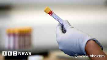 Blood test delays continue after cyber attack - GP