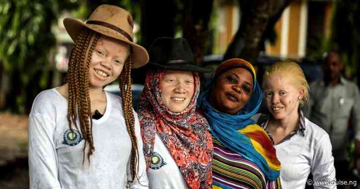 Understanding albinism: Realities and the need for awareness