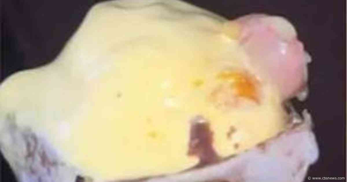 Doctor says he found part of a human finger in his ice cream cone