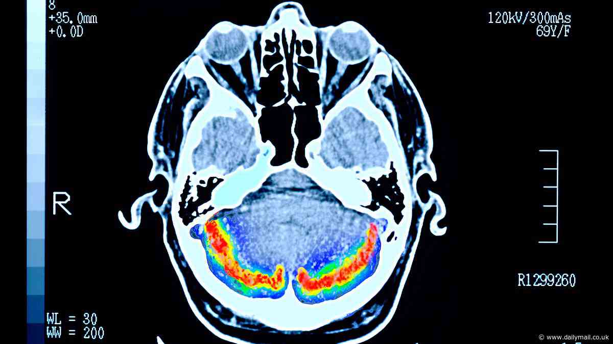 Man, 29, takes a bullet to the BRAIN from close range and survives - despite a 97% chance of dying